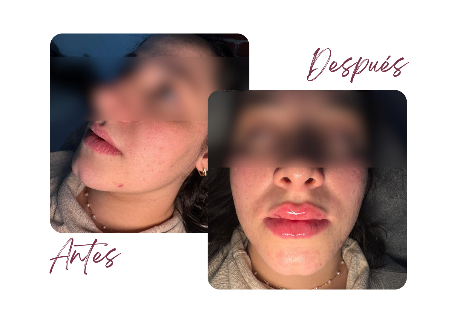 Antes y Después