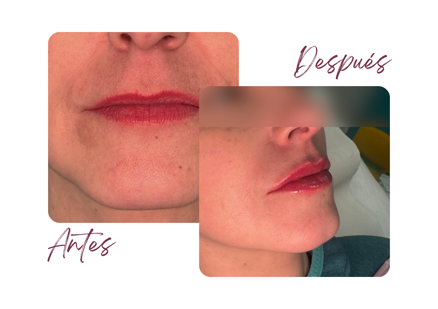 Antes y Después