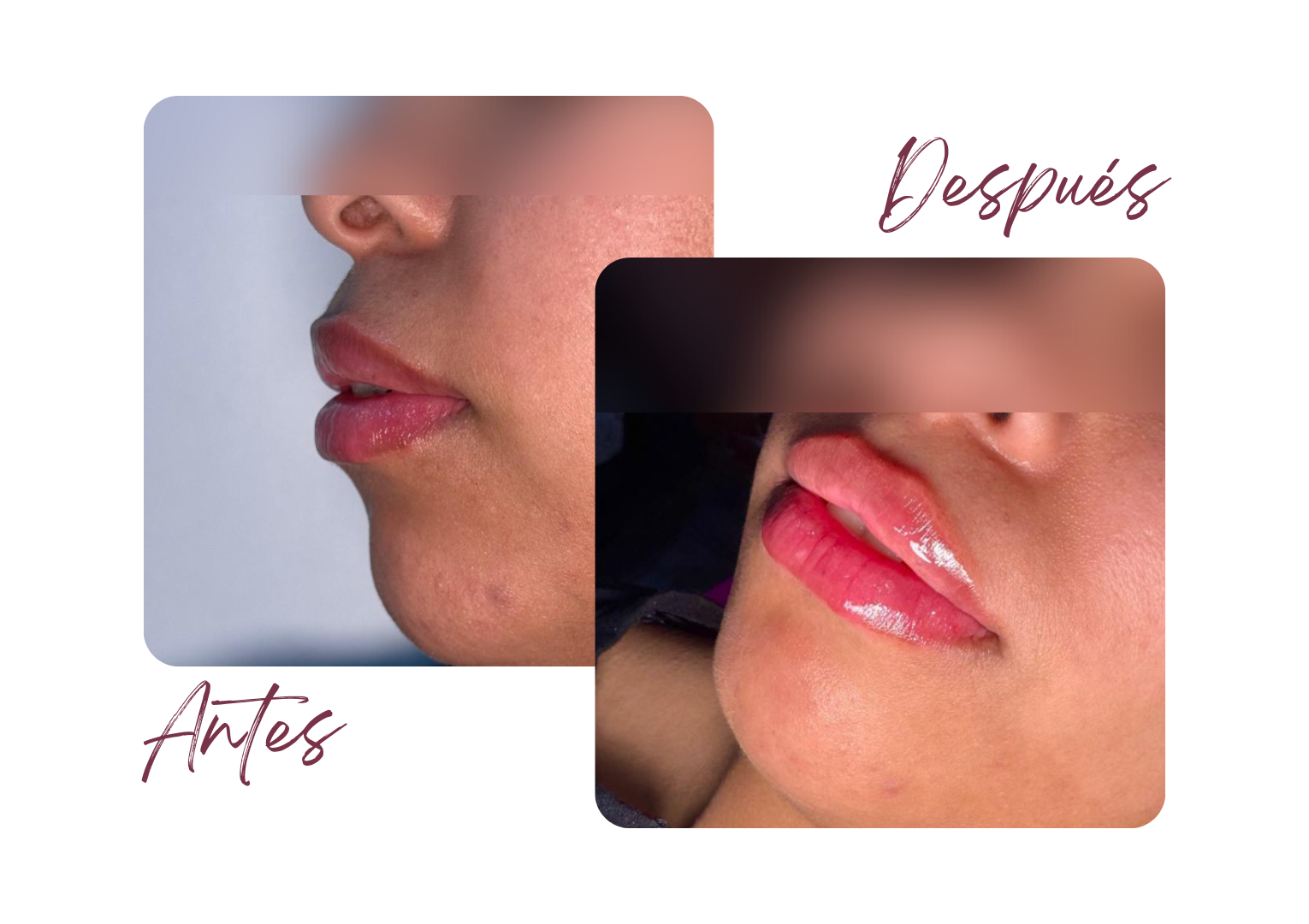 Antes y Después