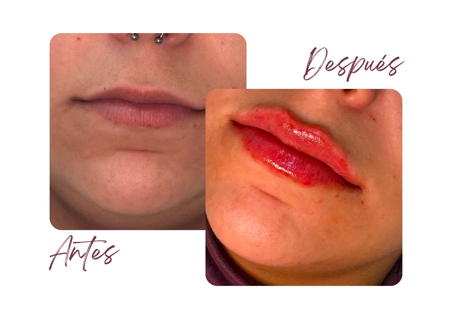 Antes y Después