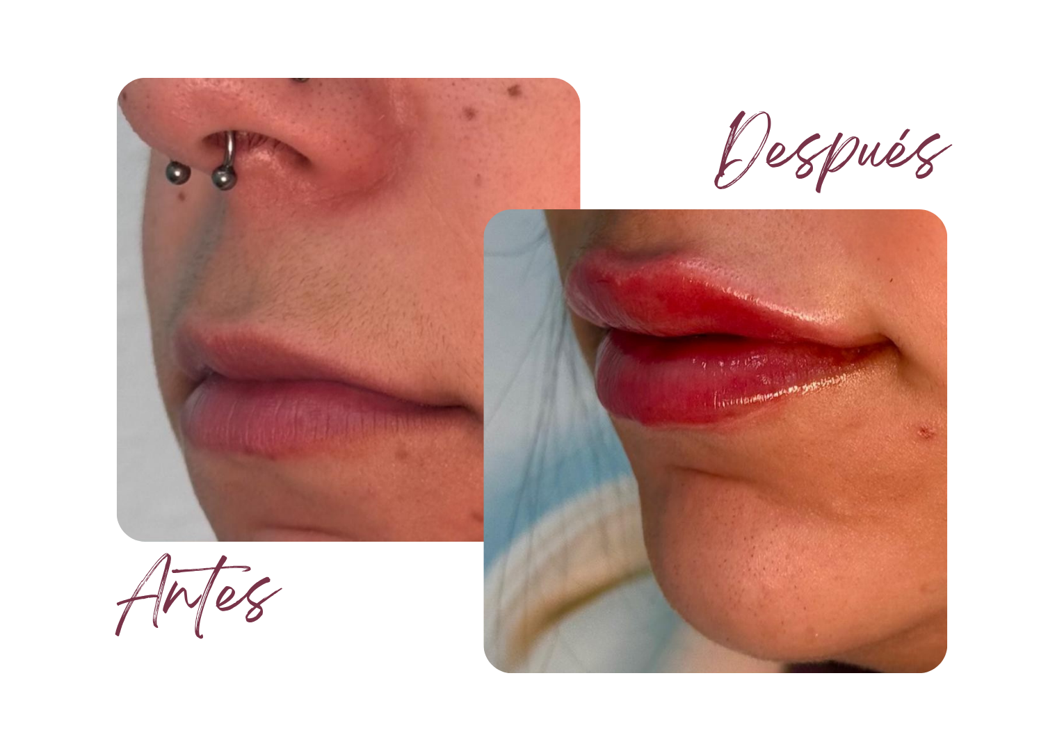 Antes y Después