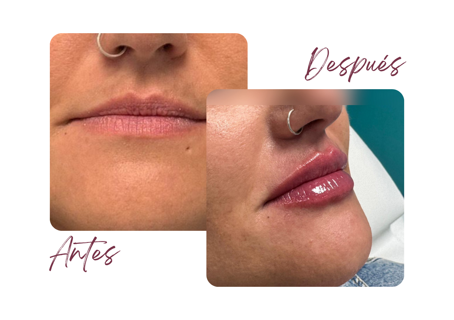 Antes y Después