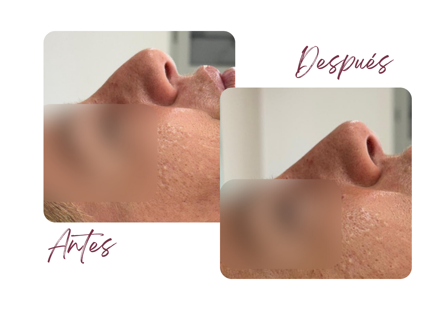Antes y Después