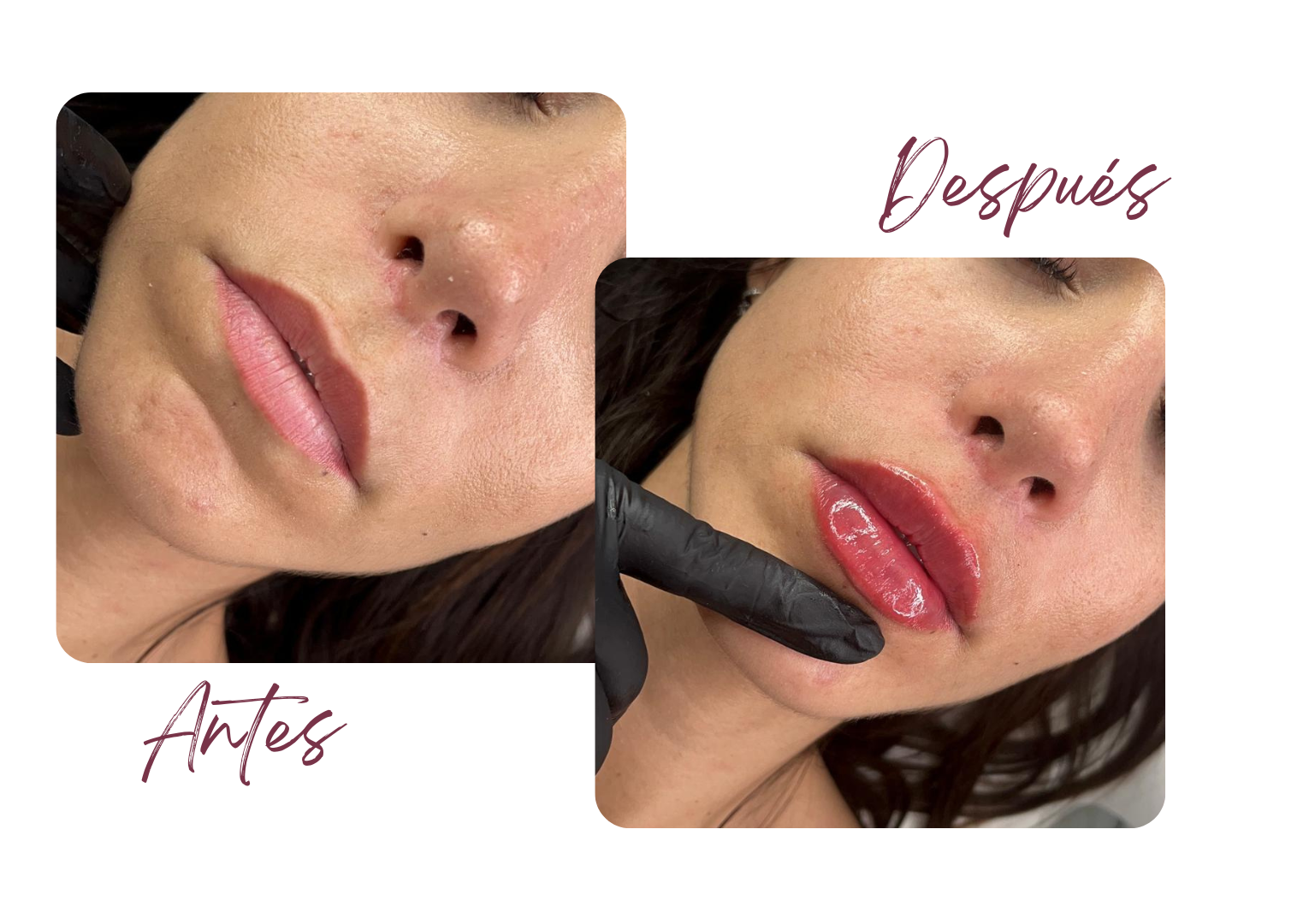 Antes y Después
