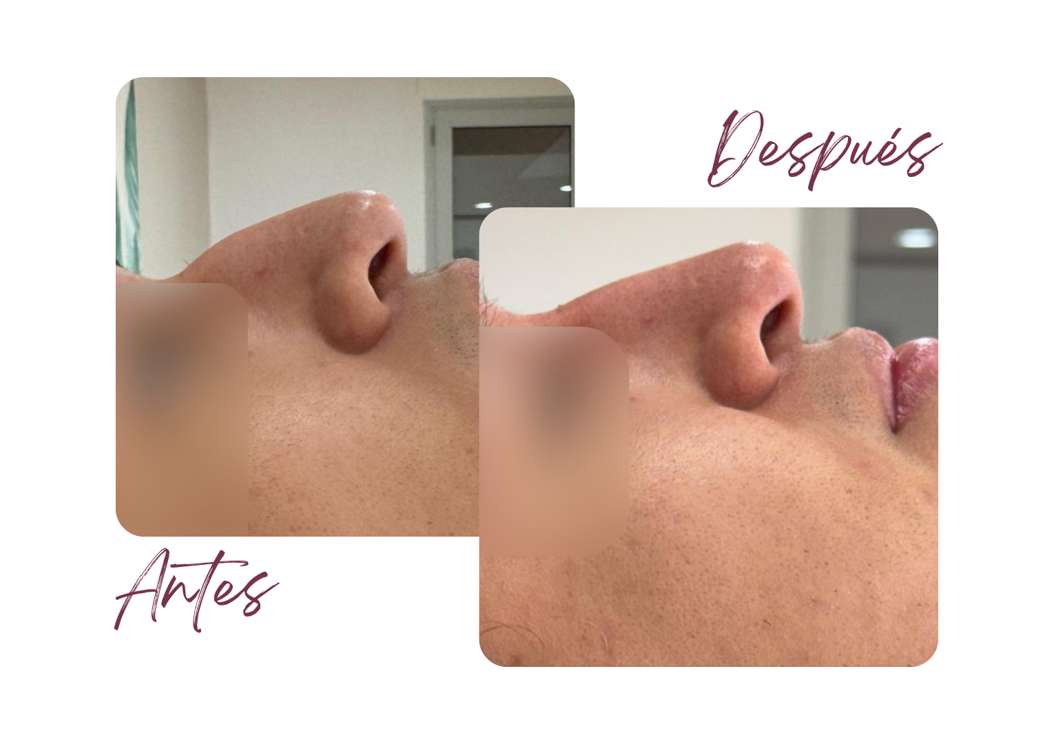 Antes y Después
