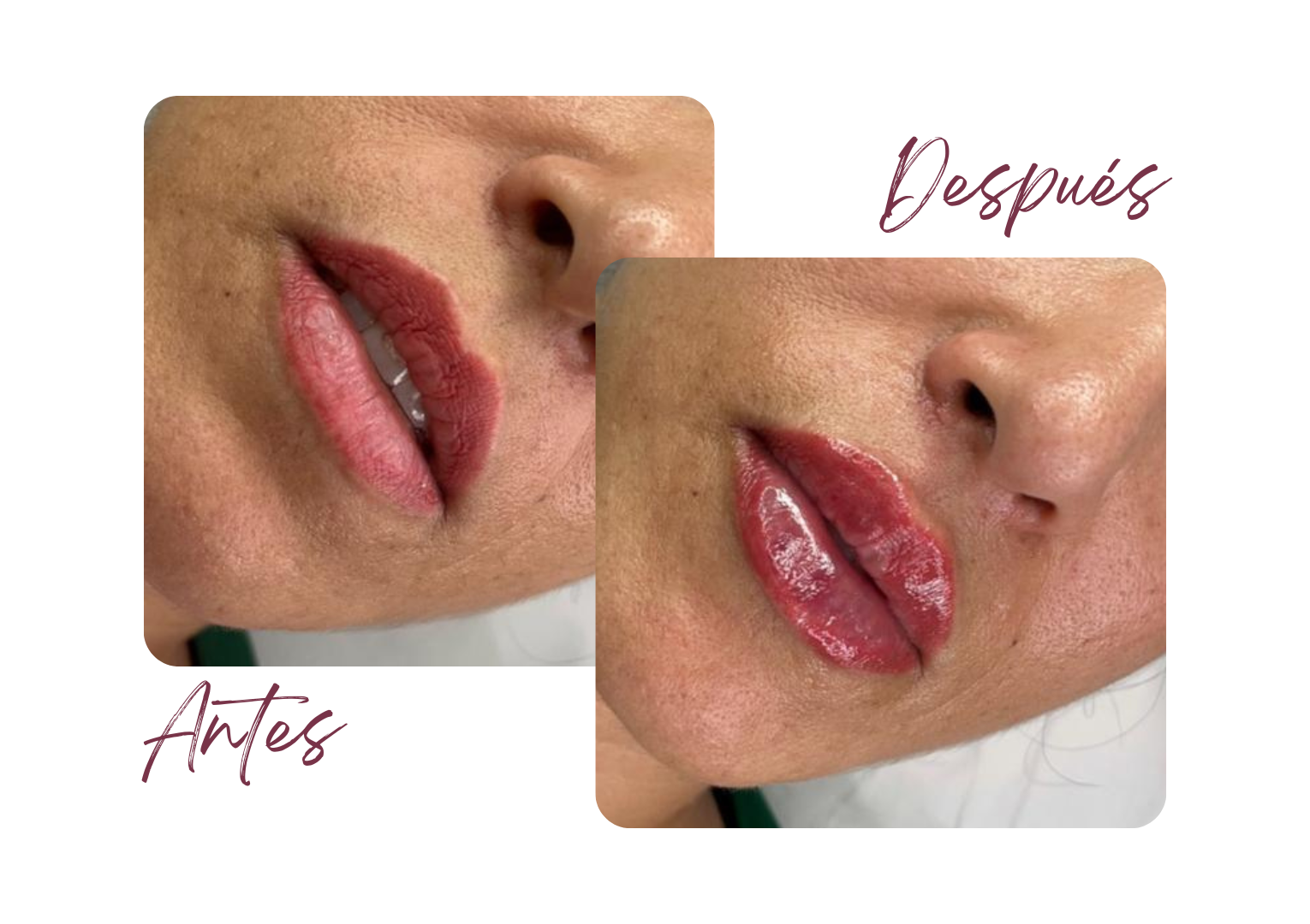 Antes y Después