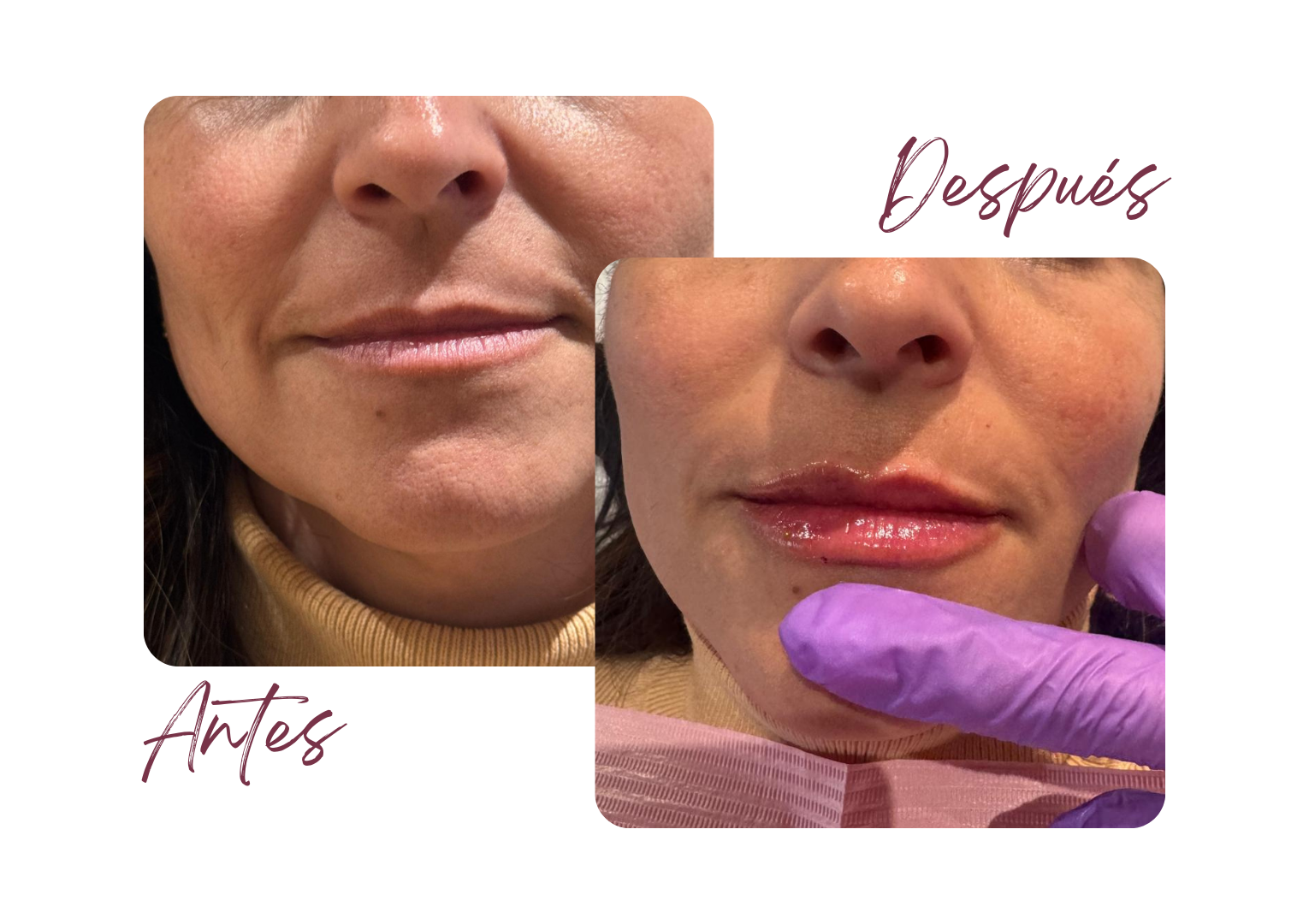 Antes y Después