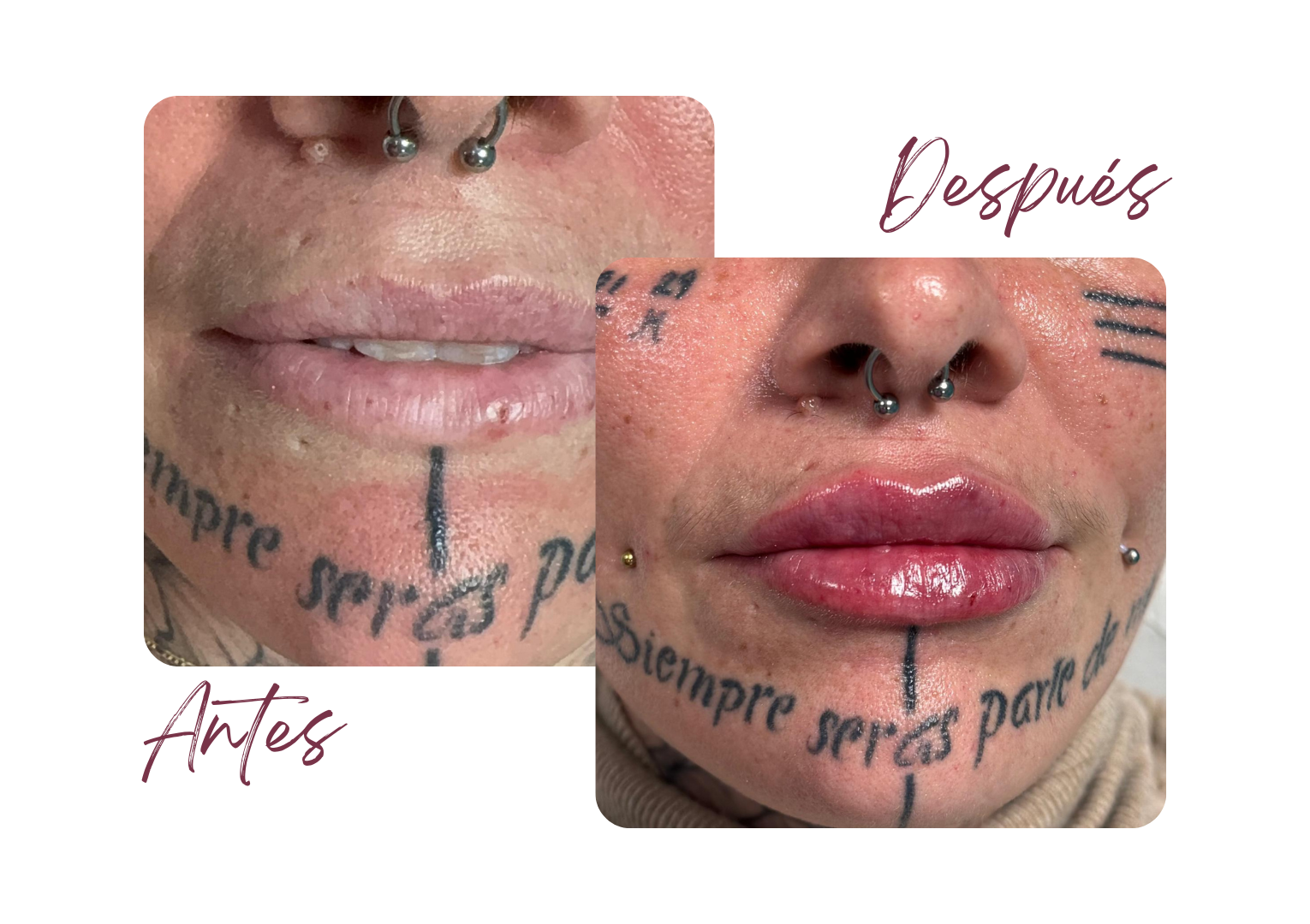 Antes y Después