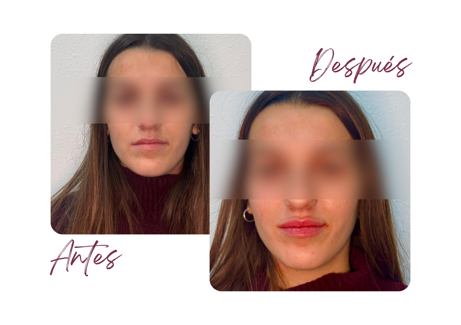 Antes y Después