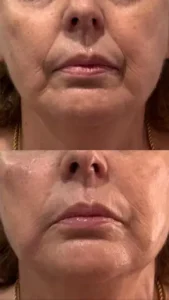 WhatsApp Image 2025-08-06 at 20.14.23